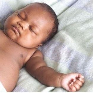 mybrownbaby  skin theyre  healing african american babies skin