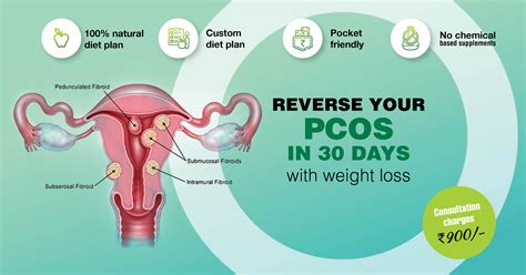 reverse  pcos   days diet plan  lose weight  pcos