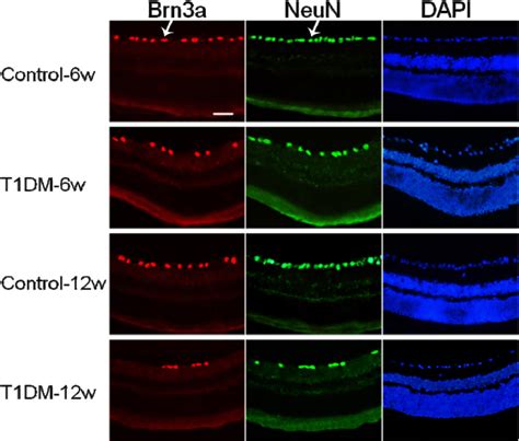 retinal ganglion cells  double labeled  brna  neun
