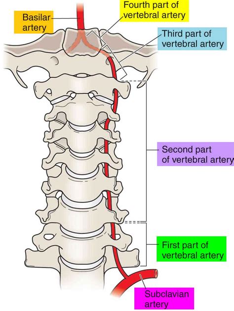 Vertebral Artery Injury Spine Orthobullets