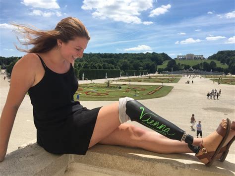 woman travels world prosthetic leg photos reddit
