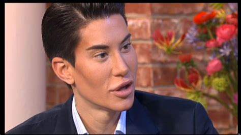 Real Life Ken Doll Says He Wants ‘more Plastic Surgery Pictures Video