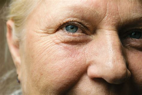 common eye diseases vision loss resources