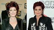 Image result for Sharon Osbourne Before Surgery. Size: 177 x 100. Source: www.lifeandstylemag.com