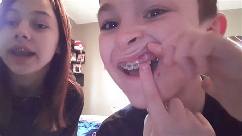 Cons Of Having Braces Ft My Sister Youtube