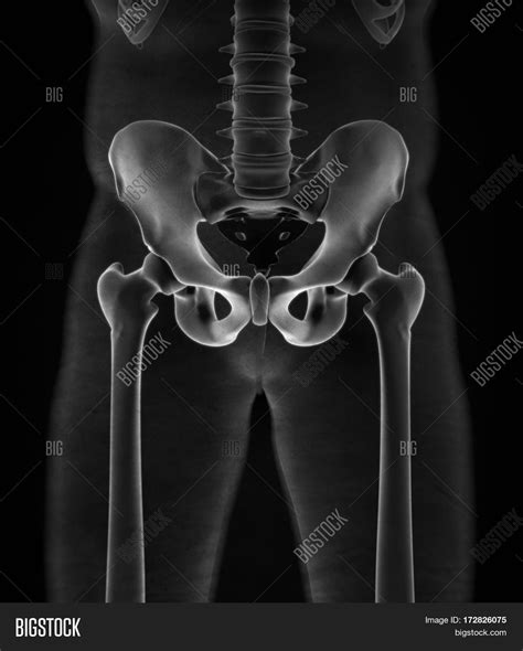 hip x ray anatomy