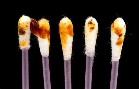 signs  health issues  earwax  reveal