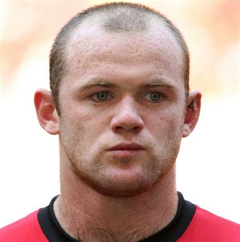 Hair Expert Reveals Wayne Rooney Should Ditch Burgers And Sex If He