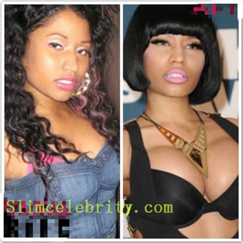 pin on celebrity plastic surgery before and after photos
