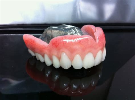 protheses dentaires clinique de denturologie landry lavertu