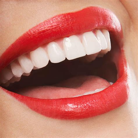Dental Care How To Whiten Teeth Naturally For A Brighter