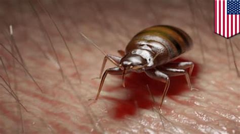 Worst Bed Bug Infestation Ever Found In Maryland Home