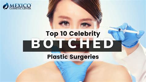 plastic surgery news archives mexico cosmetic center