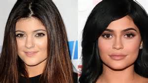 Kylie Jenner Before And After What She Really Looks Like