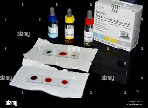 blood sample    observe blood group   blood group kit