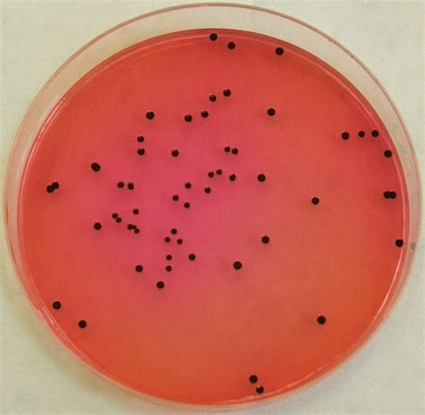 salmonella xld proteus xld bacterias em meio de cultura fotos