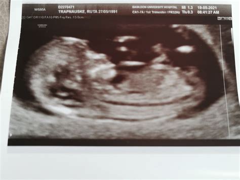 weeks scan babycentre