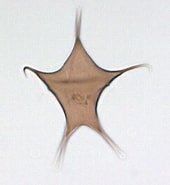 Afbeeldingsresultaten voor "acantholithium Stellatum". Grootte: 170 x 185. Bron: www.marum.de
