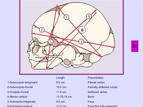 fetal skull dimensions mnemonic epomedicine