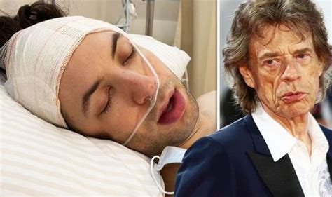 Mick Jagger S Son Lucas Undergoes Ear Surgery And Is Pictured