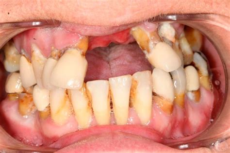 woman superglued  teeth     scared  dentists