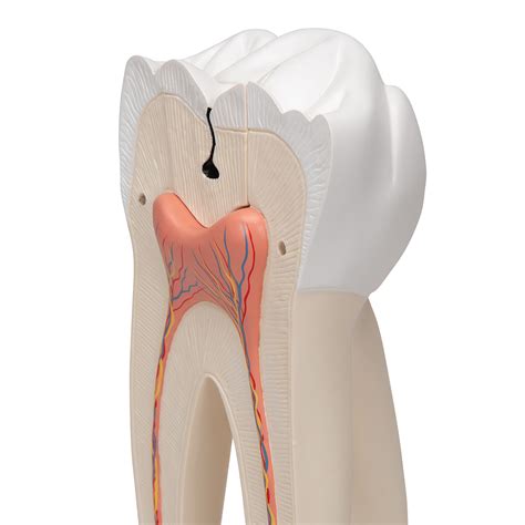 giant molar  dental cavities human tooth model  times life size