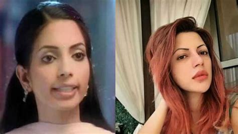 top 10 tv actresses who underwent plastic surgery view pictures