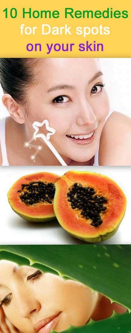 dark spots you can surely try some simple home remedies to accelerate