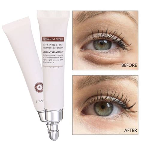 eye serum  dark circles puffiness  eye reduce fine sale