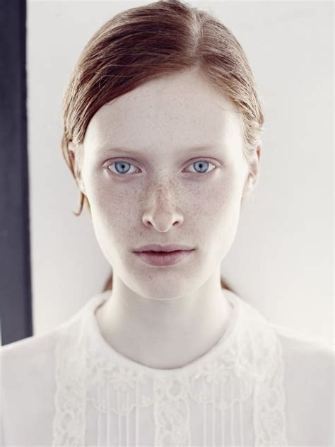 26 Best Images About Freckles Can Be Beautiful On Pinterest