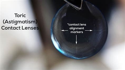 contact lenses  astigmatism   alignment