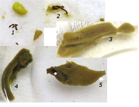 i need help identifying these found in my stool at parasites support forum alt med with