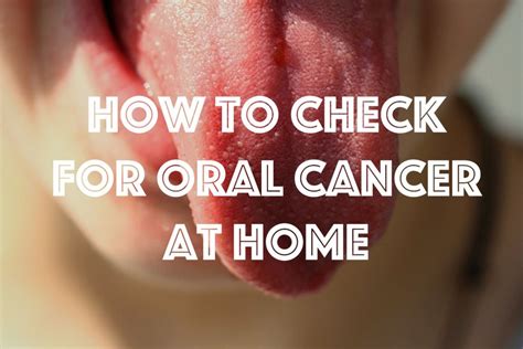 check  mouth cancer  home healdove