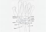 Dorsal Instability Ligaments Ligament Volar sketch template