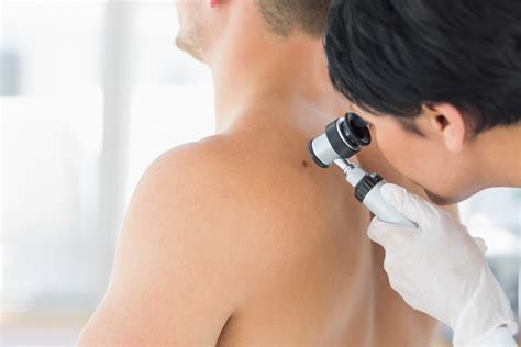 How To Check For Skin Cancer Mullumbimby Comprehensive Health Centre