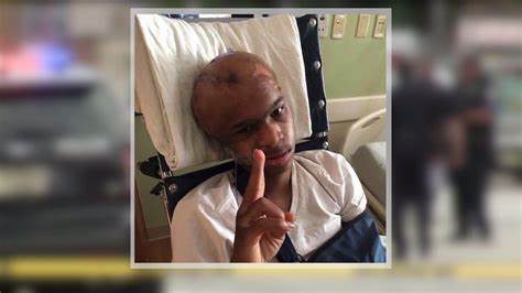 it was a miracle teen survives being shot in head recovers from