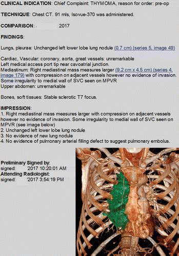 Multimedia Enhanced Radiology Reports Concept Components And
