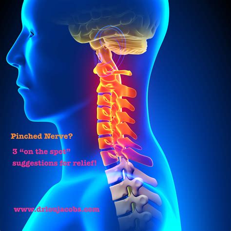 pinched nerve   neck      spot   pain