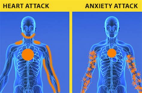 Panic Attack Or Heart Attack How To Know The Difference