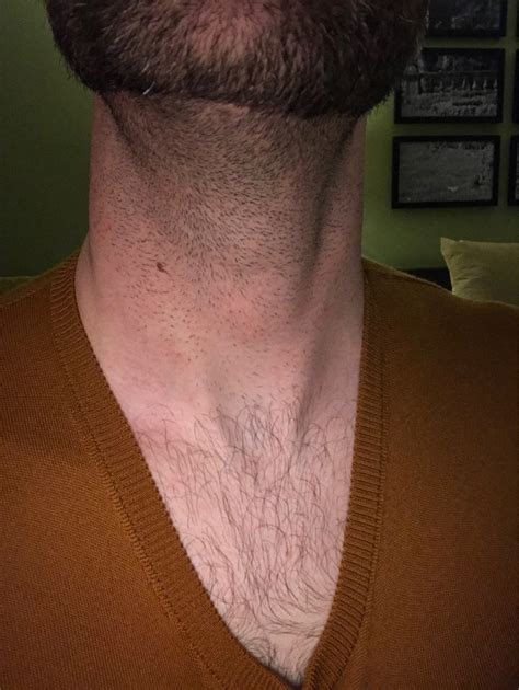 question  chest hair  beard beard board