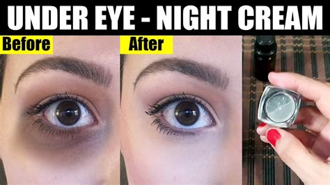 Best Eye Cream For Dark Circles That Remove All Acne