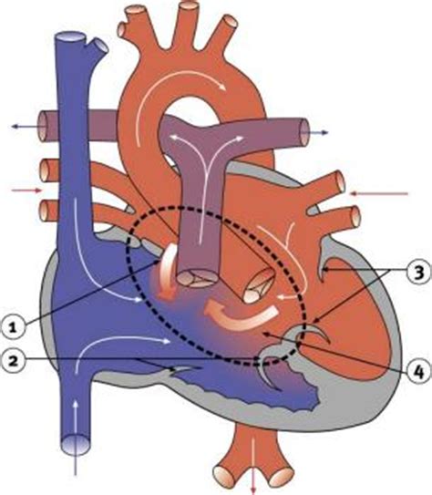 province  mb  pcsir ch  atrioventricular canal defect