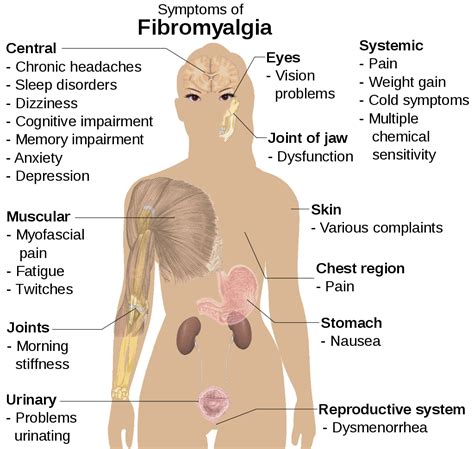 Fibromyalgia Diagnostic Criteria And The Danger Of Misdiagnosis