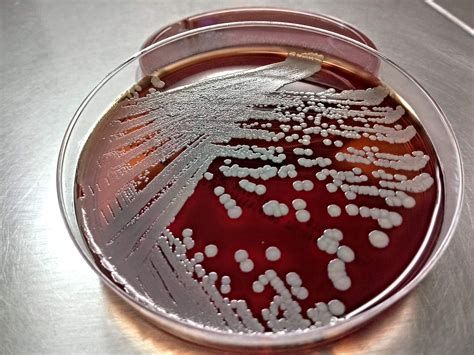 uji biokimia  karakteristik staphylococcus aureus laboratory