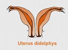 Bildergebnis für Uterus Didelphys. Größe: 136 x 100. Quelle: www.babycenter.ca