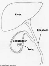 Gallbladder Drawing Getdrawings sketch template