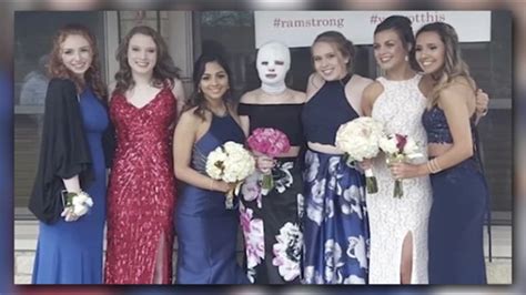 Severely Burned Girl Gets Prom Surprise Thanks To Caring Friends