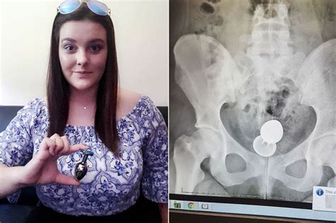 woman issues warning after having four inch sex toy surgically removed from her bottom daily