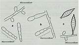 Fungi Macroconidia Microconidia Spores Trichophyton Epidermophyton Spp Common Genera Three Microsporum Fungal Shaped Terminology Molds Morphologic Features Related Humans Spindle sketch template