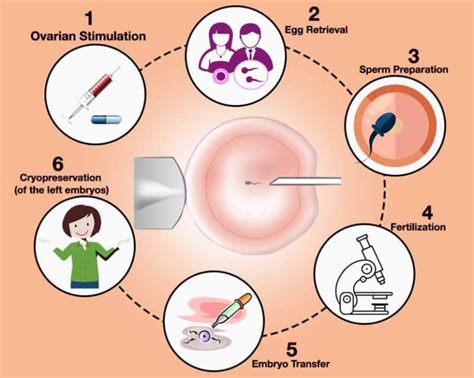 Intra Cytoplasmic Sperm Injection Icsi Fertility Specialist In Thane